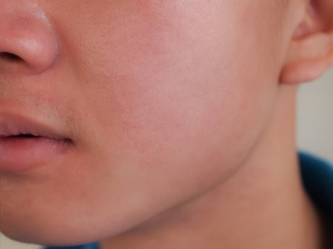 Home 53 Dermatologist recommended For daily use Oil free formula after