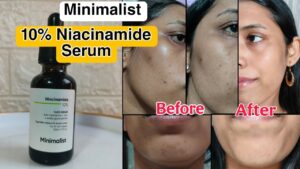 Minimalist Niacinamide 10% Face Serum (30mL) 1 Minimalist Niacinamide 10% Face Serum 30mL — Oil Control & Brightening Serum