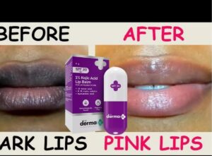 The Derma Co 1% Vitamin C Lip Balm with SPF50 (4.5g) 3 The Derma Co 1% Vitamin C Lip Balm SPF50 4.5g